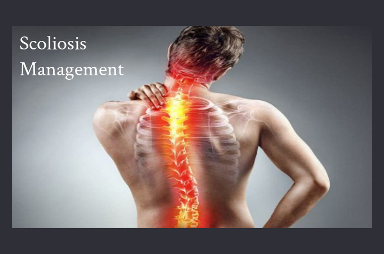 scoliosis management and therapy by a physical therapist in dearborn michigan