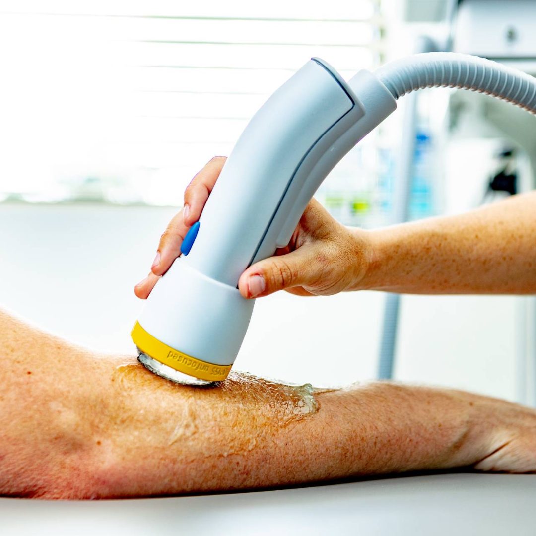 Untitled design (7) SoftWave Therapy in Dearborn